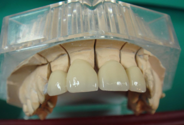VV CENTRS SIA, zobu tehniskā laboratorija