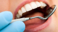Teeth whitening - AMALS SIA, zobārstniecība un skaistumkopšana