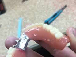 Zobu tehniķa Ildzes Rimicānes zobu protēžu laboratorija
